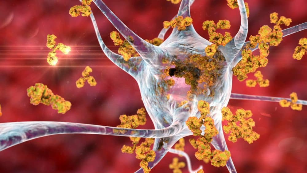 Autoimmunity and Immune Dysregulation in Long COVID