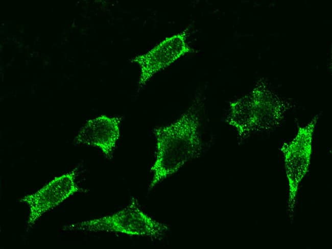 Beta 2 adrenergic receptor (B2AR) autoantibody